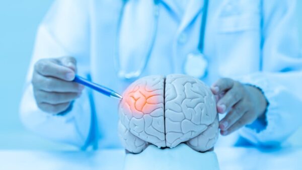 Neurologist pointing at a human brain model, highlighting a lesion, used for medical education and study.