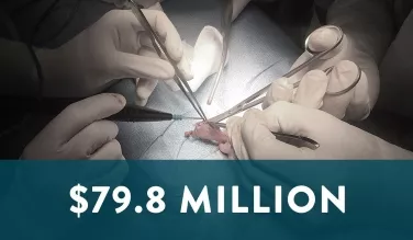 Trial verdict for defective surgical stapler